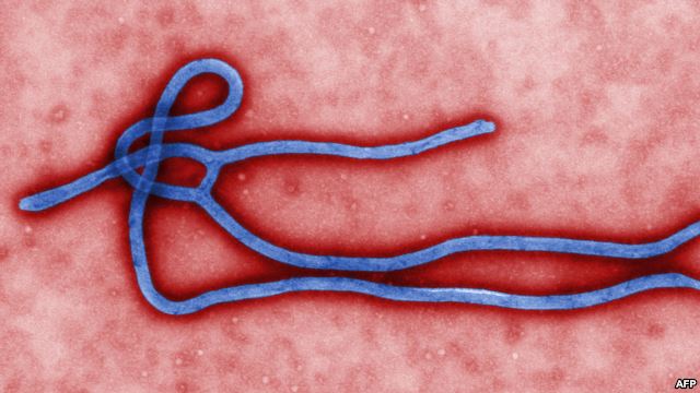 Ebola Vaccine Tests Planned Soon, NIH Says | CNN