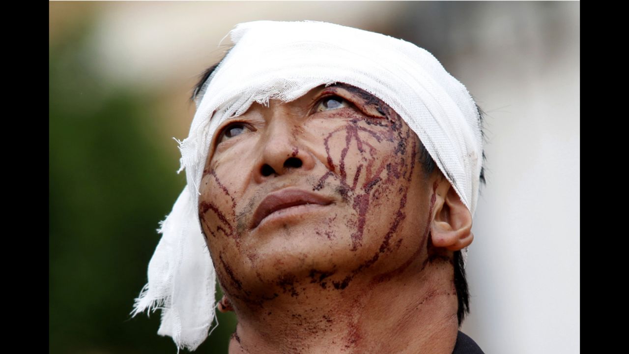 A man with dried blood stains on his face stands on a street in Longtoushan on August 4.