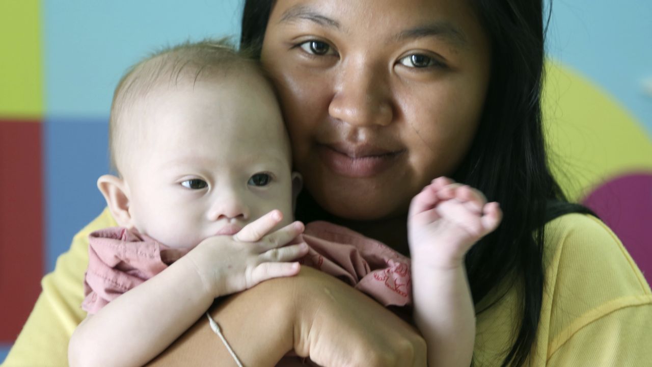 Pattaramon Chanbua poses her baby boy Gammy at a hospital in Thailand on August 3, 2014. 