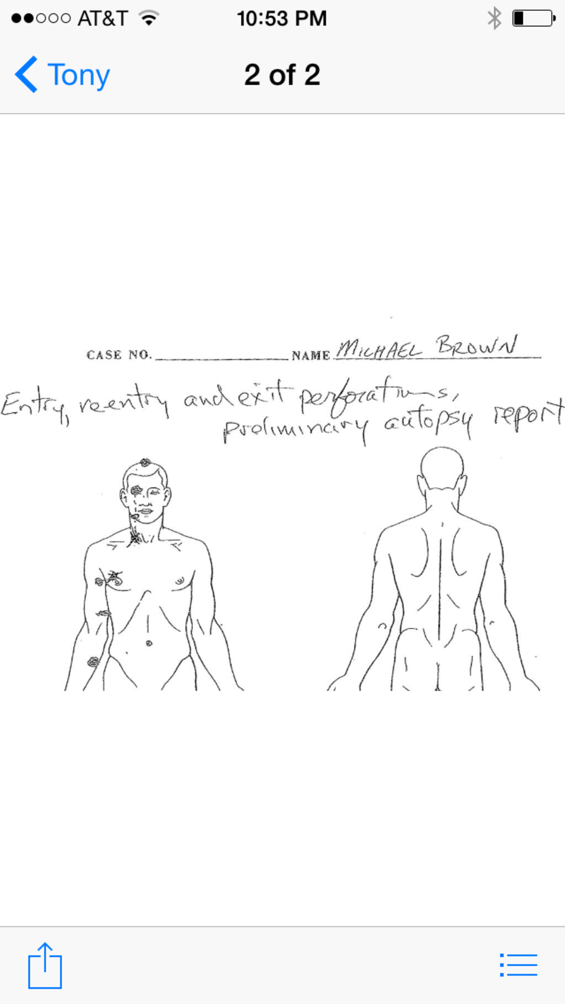 A diagram from the autopsy shows entry and exit wounds.