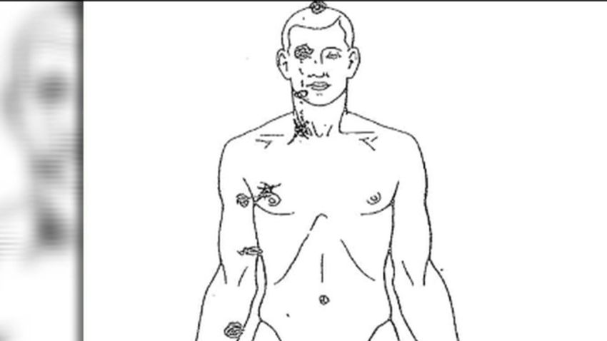 lead dnt johns private autopsy michael brown _00003509.jpg