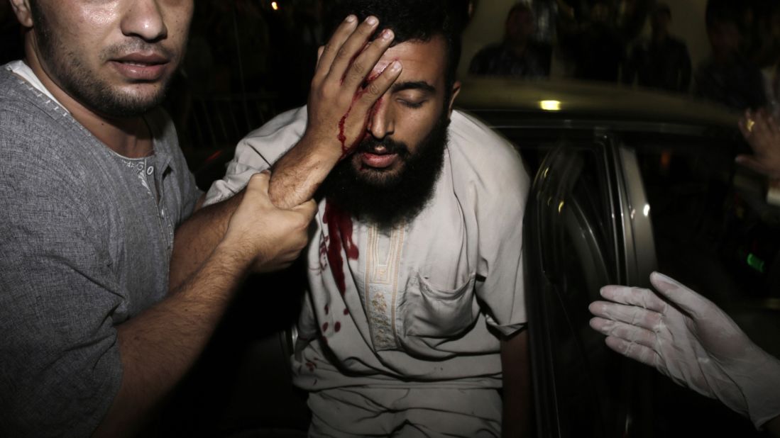 An injured Palestinian man is helped into the Shifa hospital in Gaza City on August 19.