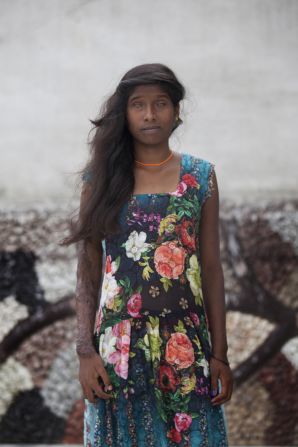 Chanchal, along with her sister Sonam, were attacked after they protested when a group of boys were teasing them.