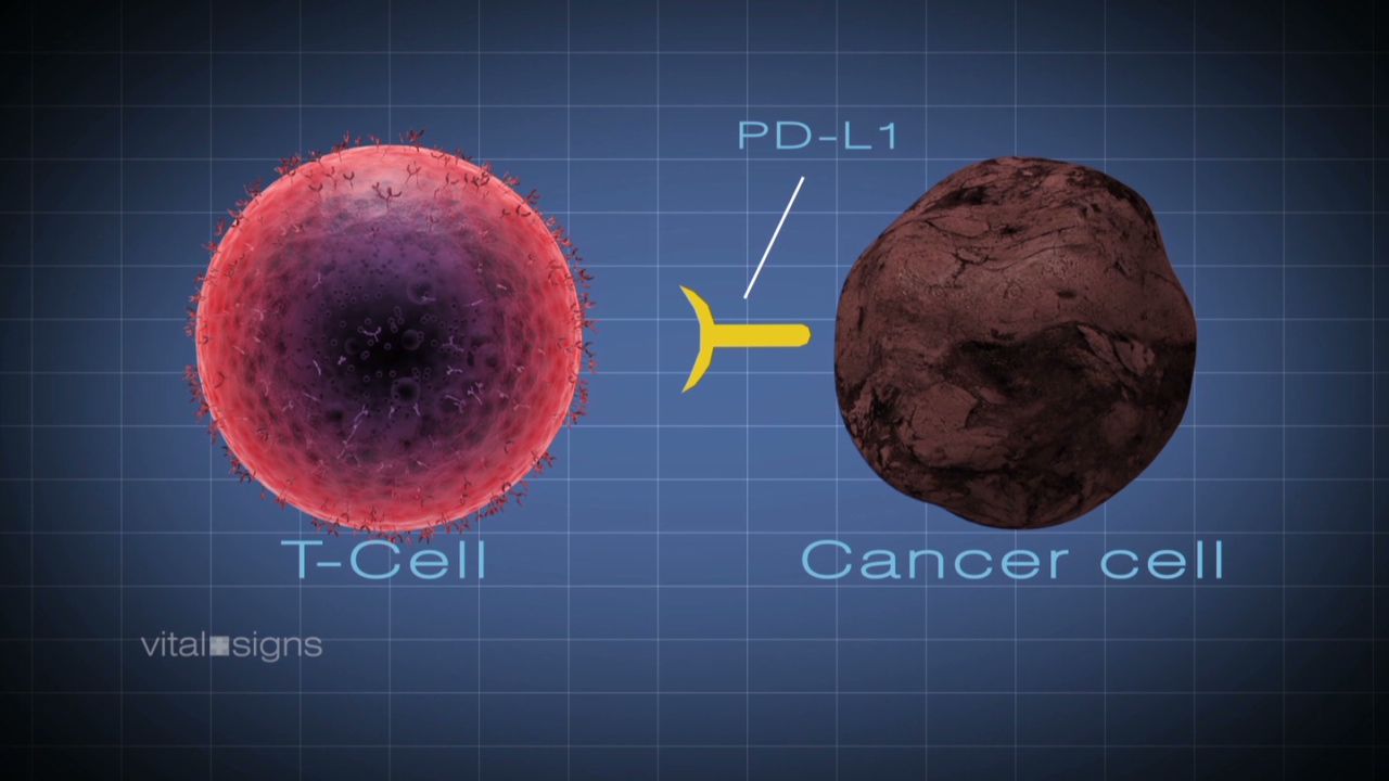 spc vital signs immunotherapy yale cancer_00003118.jpg