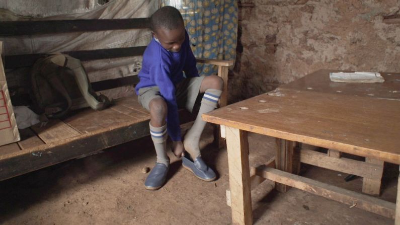 According to Kenya's Ministry of Health, 1.4 million people are infested with jiggers, a debilitating foot parasite. Around 80% of those affected are school-aged children. 