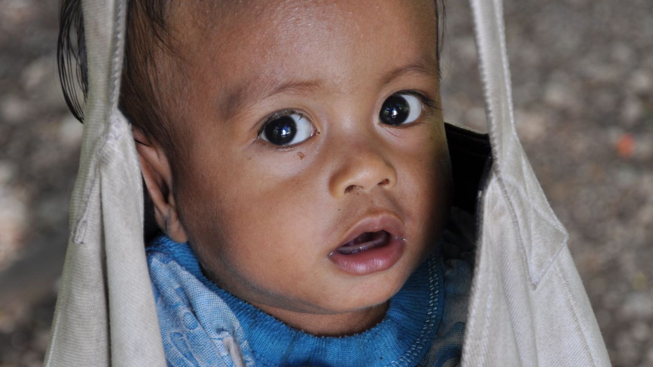 A young child is weighed at a malnutrion center. Almost half of 70 children registered at the center were found to be underweight.