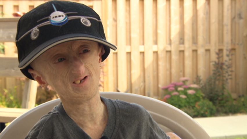 Teenager's everyday symptom turned out to be a potentially deadly disease