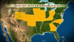 Ten states have contacted the Centers for Disease Control and Prevention for help investigating clusters of Enterovirus that's being blamed for the illness.