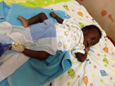 Three weeks after the operation, Paul Mukisa is steadily recovering. "The baby is eating well (breast milk) and is moving his bowels normally," says Nasser Kakembo, one of the doctors who carried out the surgery. "His lower limbs also move normally."