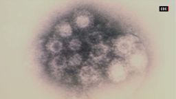 enterovirus d68 cohen mg orig_00001503.jpg