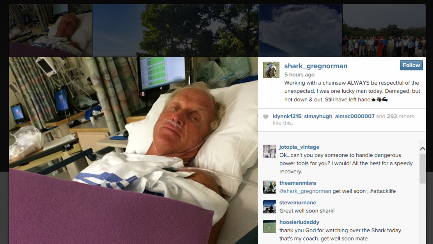 Greg Norman posted photos on Instagram showing himself in the hospital after his chainsaw accident.