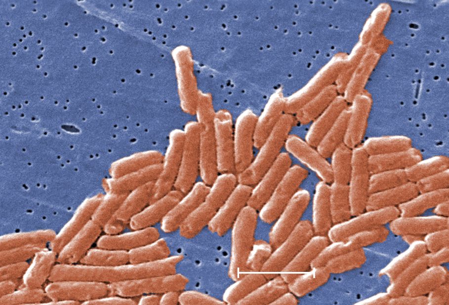 In general, food should be reheated until it's steaming hot, as this kills off germs that reappear after food has cooled. Pictured, salmonella bacteria.