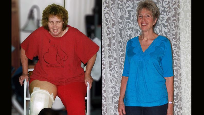 Each year <a  target="_blank" target="_blank">TOPS</a>, a nonprofit weight loss support organization, recognizes members who followed the club's slogan of "Taking Pounds Off Sensibly." Victoria Brazzle from Pahrump, Nevada, lost 101 pounds. Click through the gallery to see more success stories. 