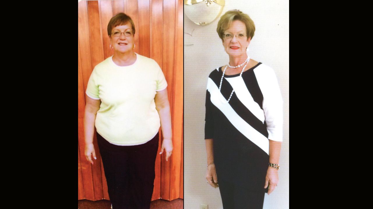 Sharon Huffmire from Midway, Arkansas, is 104 pounds lighter.