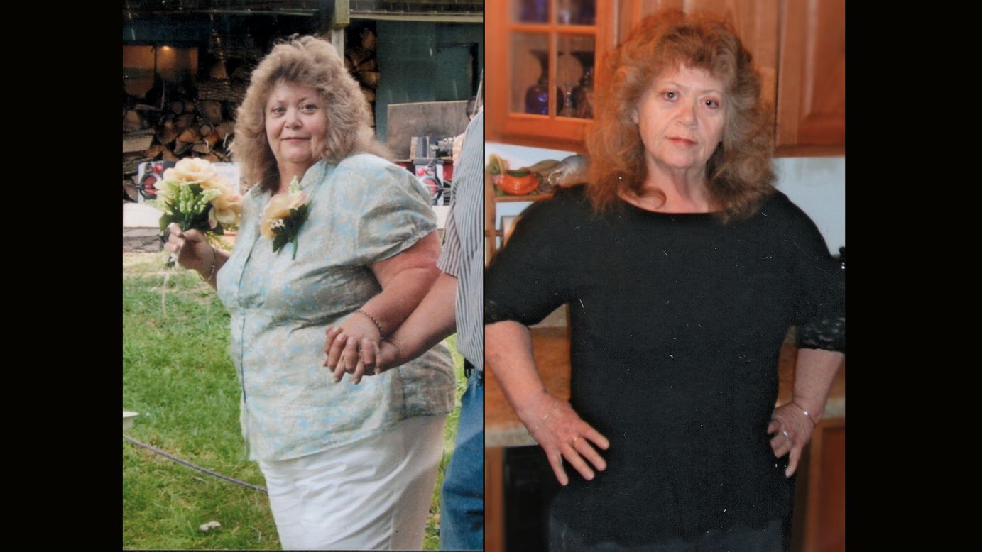 Paula Hicks from Iberia, Missouri, dropped 107 pounds.