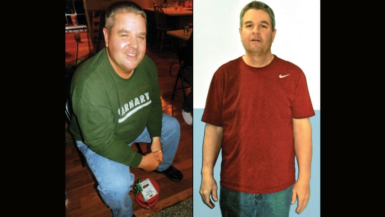 Patrick Davis from Granite City, Illinois, lost 91 pounds.