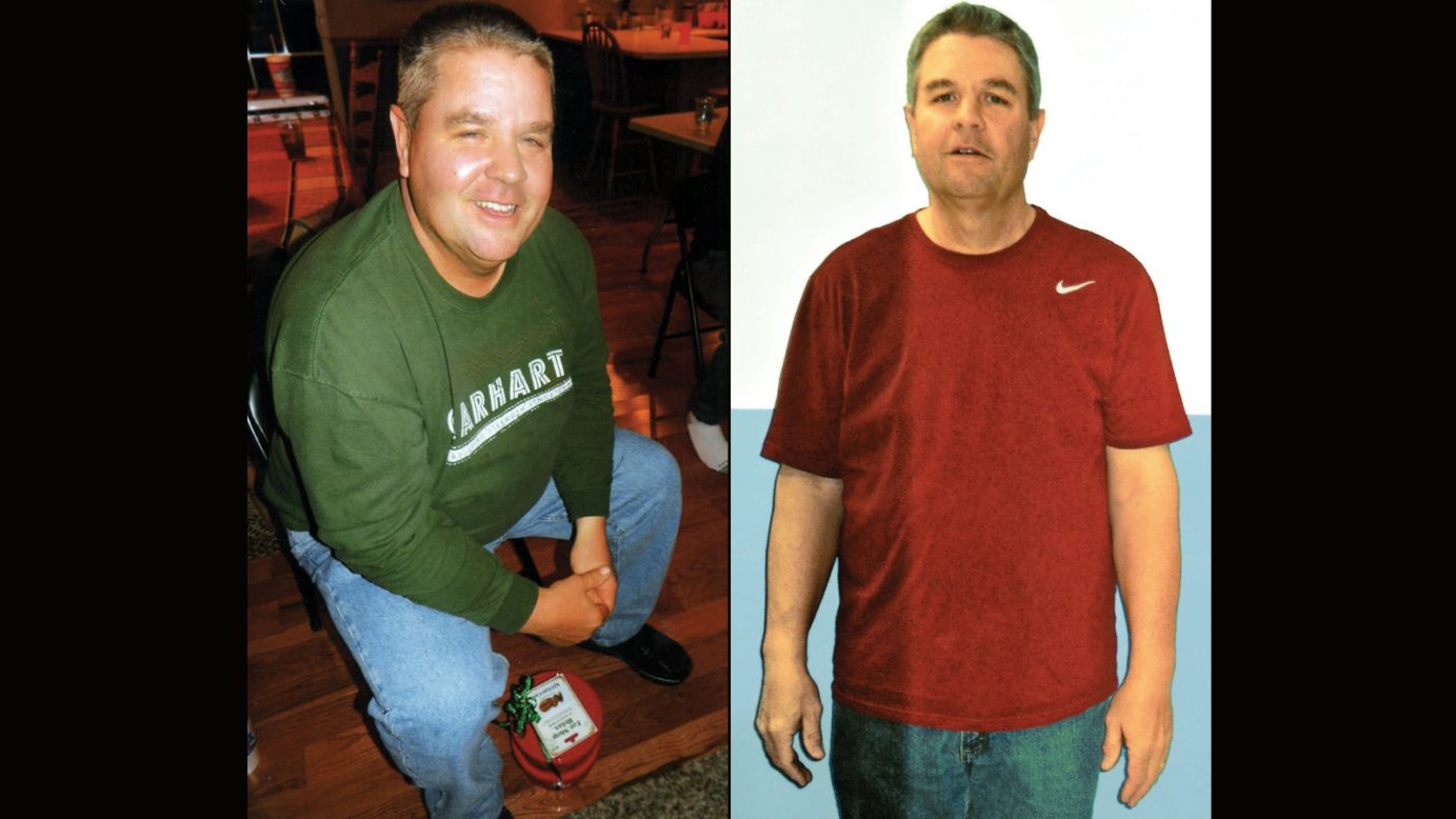 Patrick Davis from Granite City, Illinois, lost 91 pounds.
