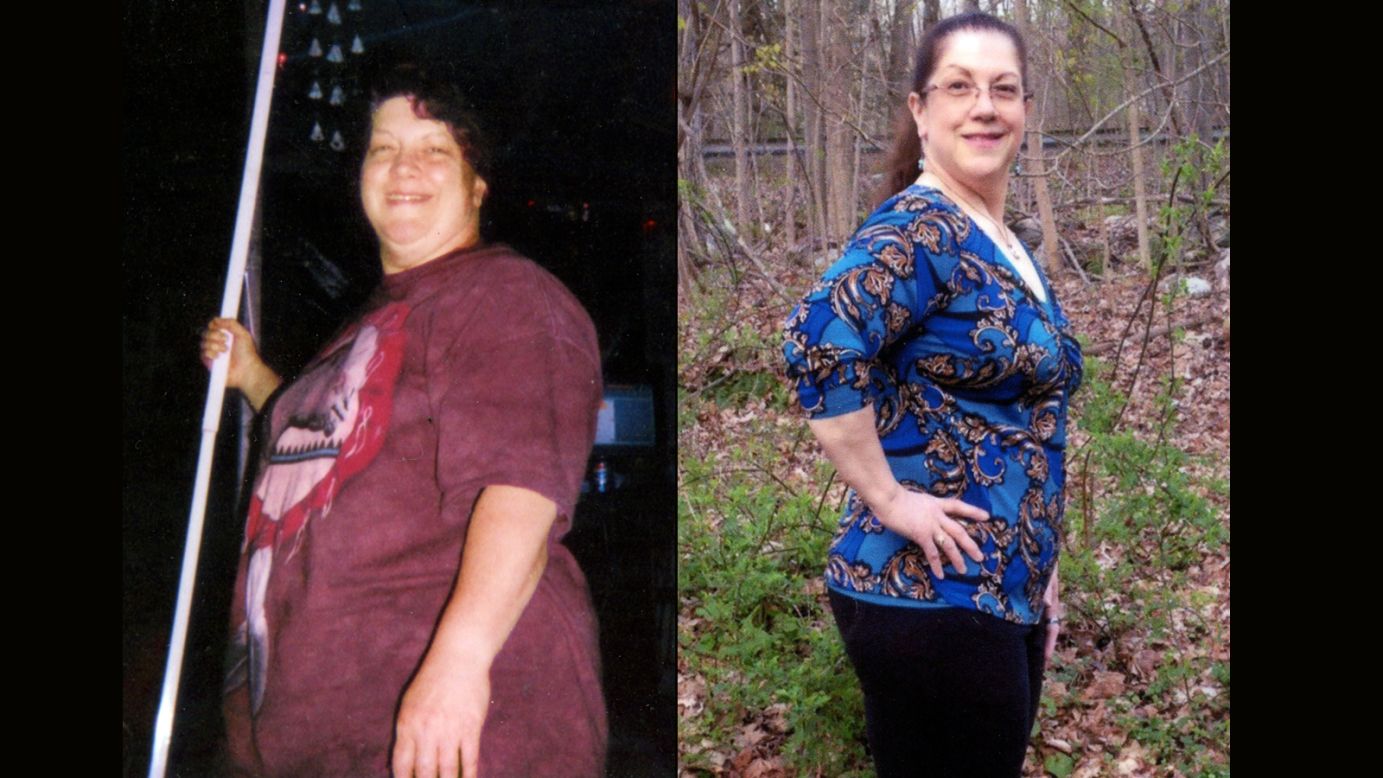 Laury Mathews from Bolton, Connecticut, lost 70 pounds.