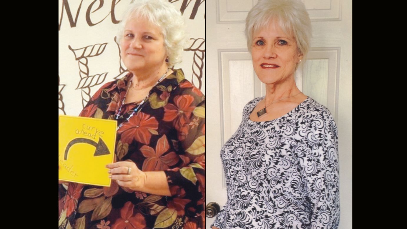 Kathy Kirby from Temecula, California, lost 136 pounds.