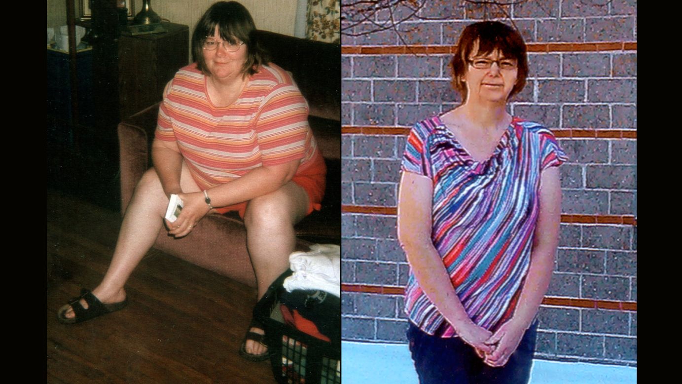 Gladys Richards from Sabattus, Maine, lost 101 pounds.
