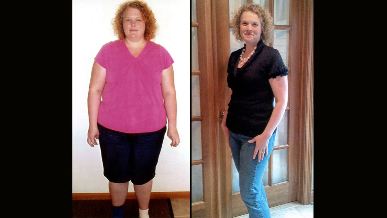 Amanda Zumbrun from Huntington, Indiana, lost 98 pounds.