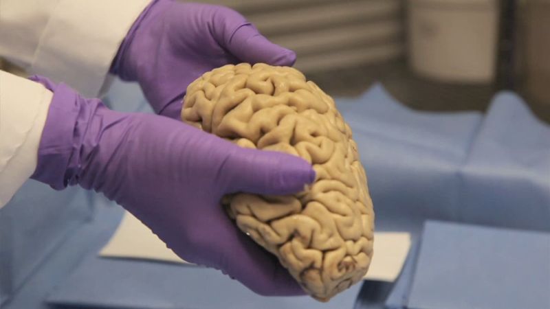 Lab holds 2,000 brains | CNN