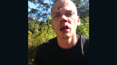 Police took Aaron Lewis's photo after a Sunday traffic accident.