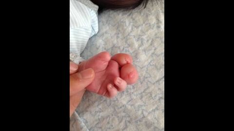 Still, Gracey could not imagine amputating his two swollen fingers. "I knew that he used those fingers. He used them to put his pacifier back in and to rub his eyes."