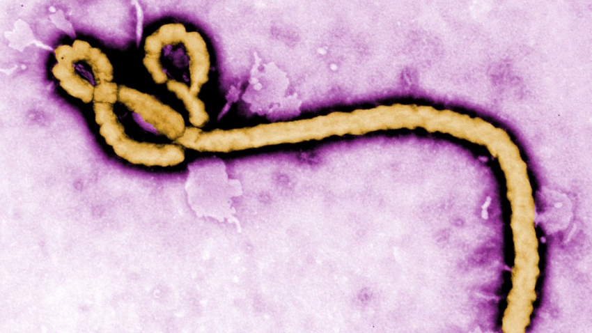 orig cdc ebola