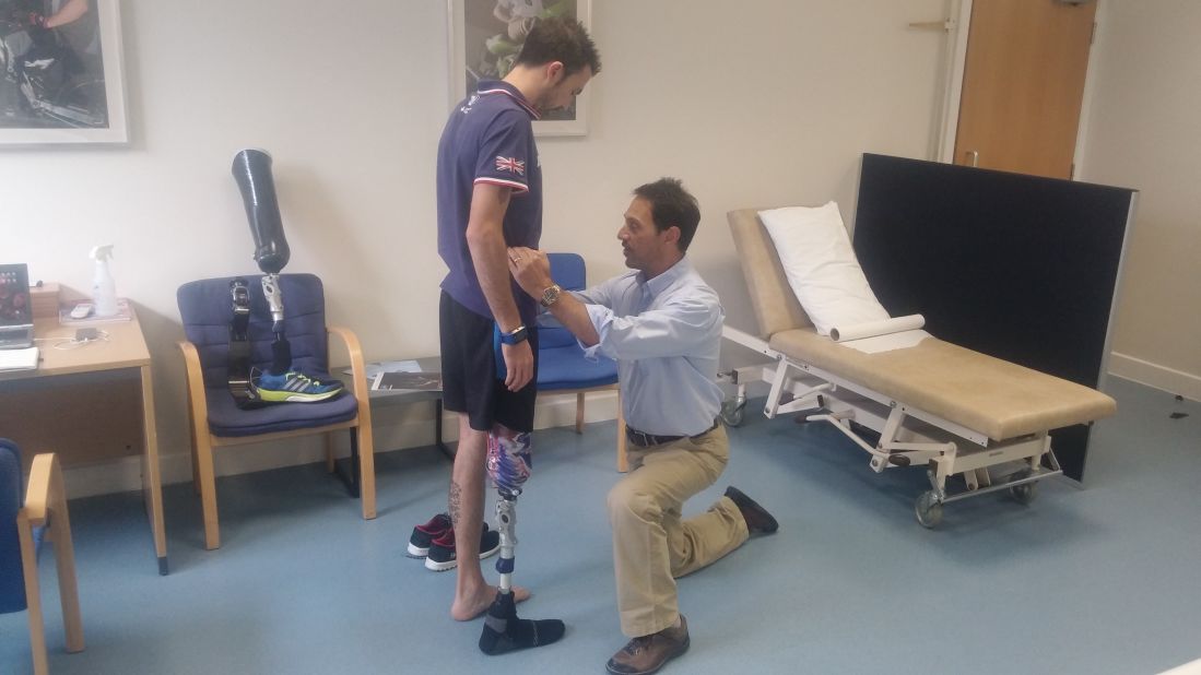 Lewis working with prosthetists at Pace Rehabilitation in London.
