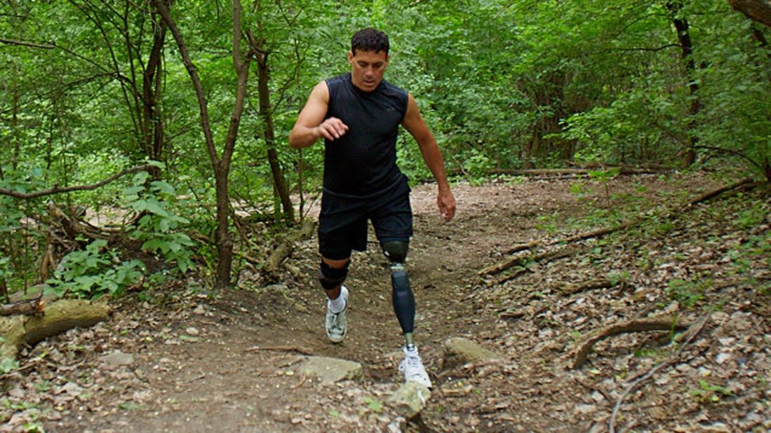 The Genium X3 - considered the most advanced prosthetic leg in the world, developed by the US military.