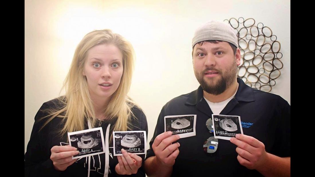 The Gardners started a Facebook page after people started sharing pictures from the ultrasound all over the Internet.