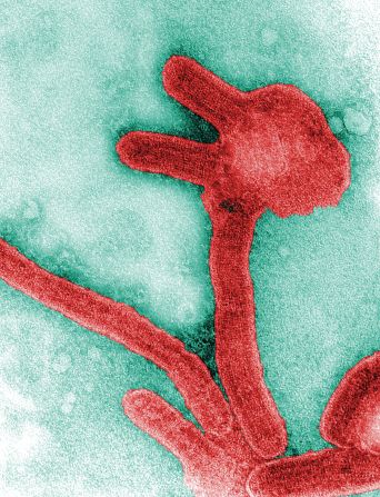 Marburg virus, pictured, is also in the same family of viruses. <a  target="_blank" target="_blank">Marburg virus diseas</a>e is more severe in terms of fatality, but outbreaks are less common.