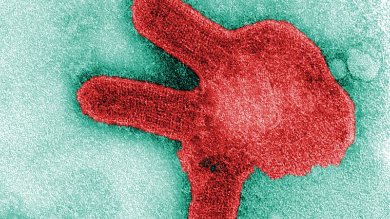 CDC varuje niektorých cestujúcich, aby sledovali symptómy vírusu Marburg pri vyšetrovaní prepuknutia v Afrike CDC varuje niektorých cestujúcich, aby sledovali symptómy vírusu Marburg pri vyšetrovaní prepuknutia v Afrike