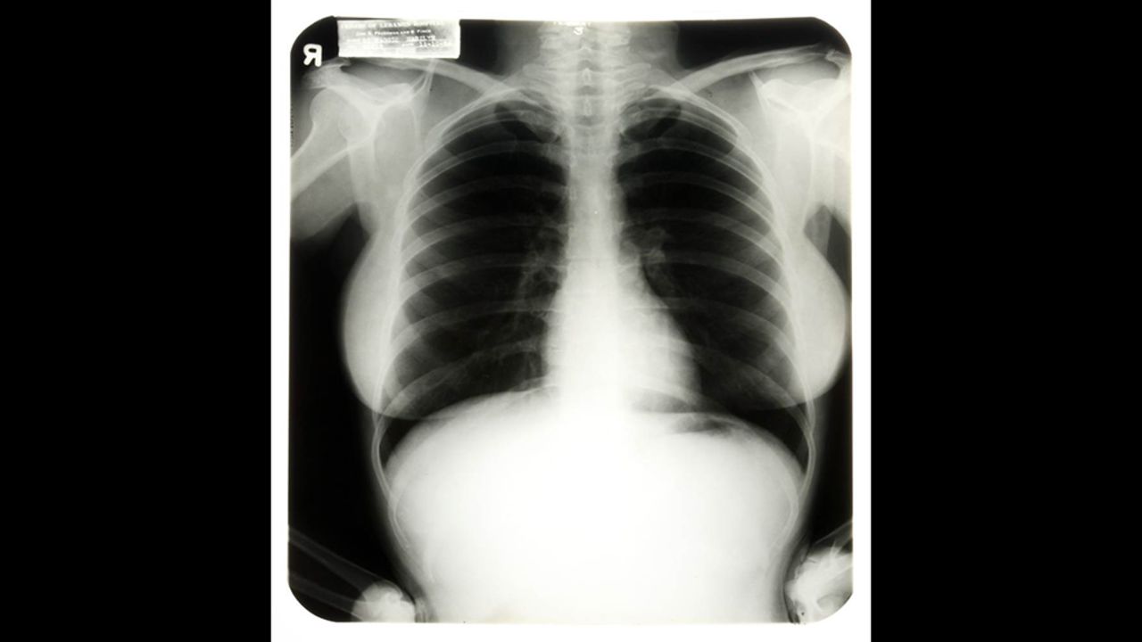 In 2010, someone wanted to see the real Marilyn Monroe -- as in, the bones that made the woman. Chest X-rays of the star from 1954 <a href="http://www.nydailynews.com/news/money/marilyn-monroe-chest-x-ray-1954-sells-45-000-las-vegas-auction-article-1.184979" target="_blank" target="_blank">were bought for $45,000</a> at an auction in Las Vegas.