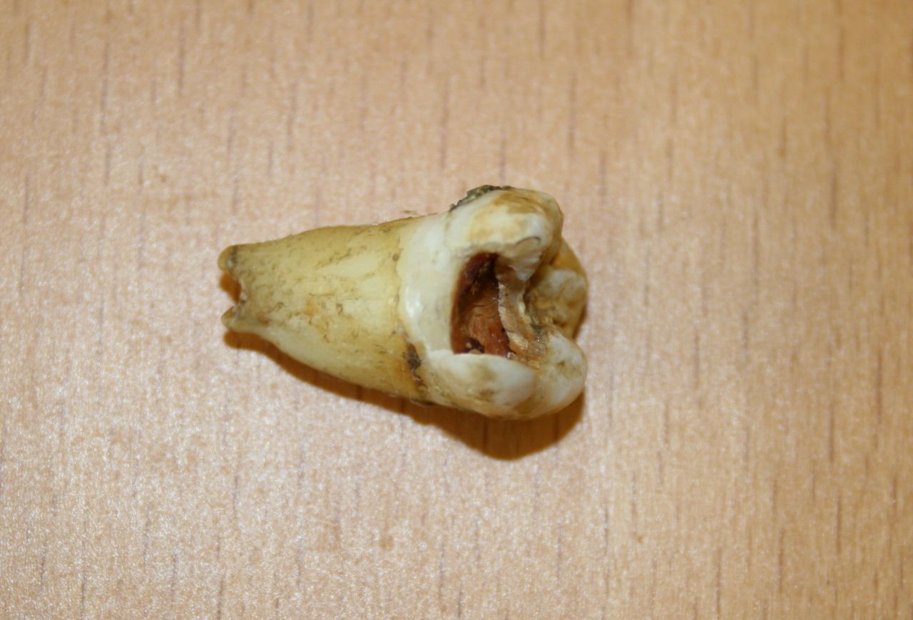 This tooth isn't the prettiest but it's also John Lennon's, which makes it supervaluable to fans. The singer handed this tooth, which has a cavity, to his housekeeper in the mid-'60s after having it pulled during a trip to the dentist.<a href="http://www.cnn.com/2011/11/05/world/europe/uk-lennon-tooth-auction/" target="_blank"> It was auctioned  for $31,200 in 2011. </a>