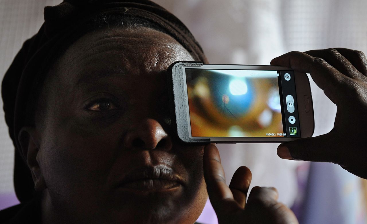 Cutting edge procedures can use retina scans to direct treatment, such as this test for glaucoma in Kenya.