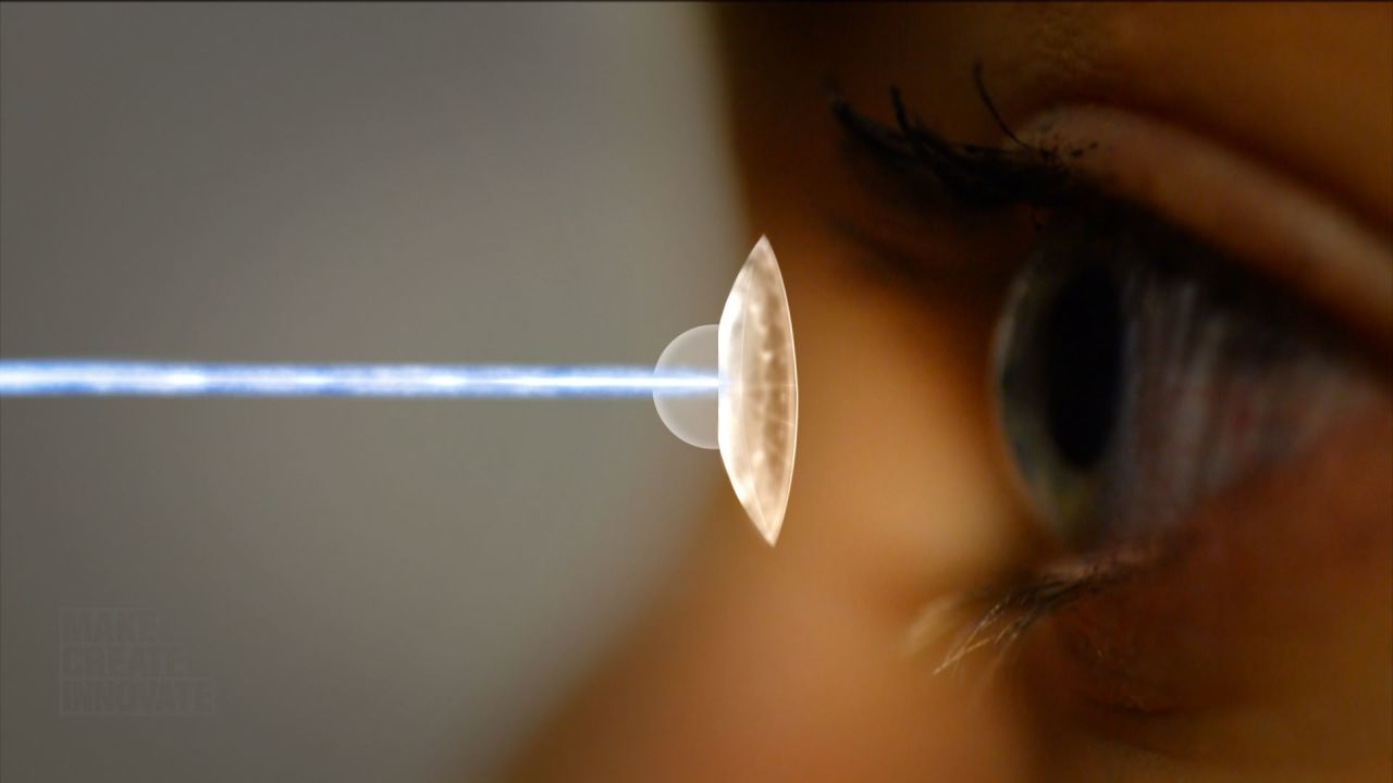 A new generation of ultra-precise femtosecond lasers promise to restore perfect vision in any patient.
