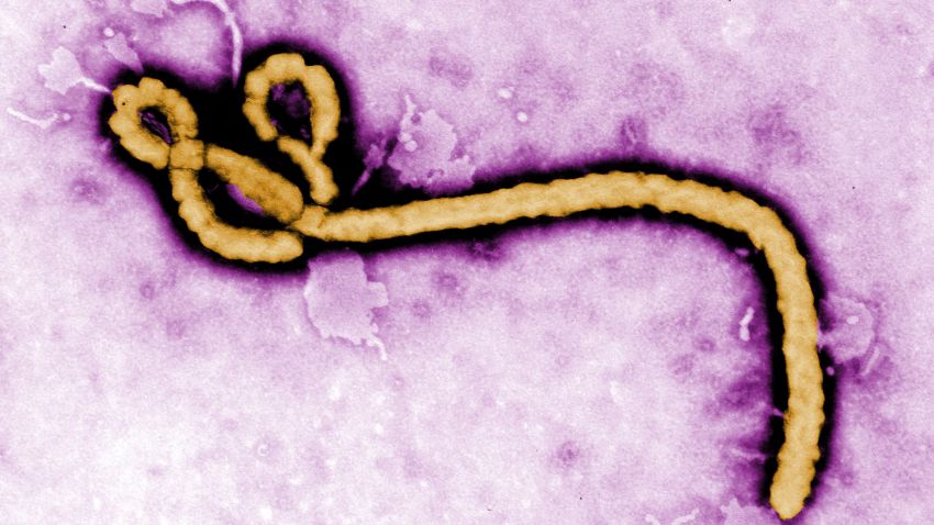 Caption:UNDATED: In this handout from the Center for Disease Control (CDC), a colorized transmission electron micrograph (TEM) of a Ebola virus virion is seen. As the Ebola virus continues to spread across parts of Africa, a second doctor infected with the disease has arrived in the U.S. for treatment. (Photo by Center for Disease Control (CDC) via Getty Images)