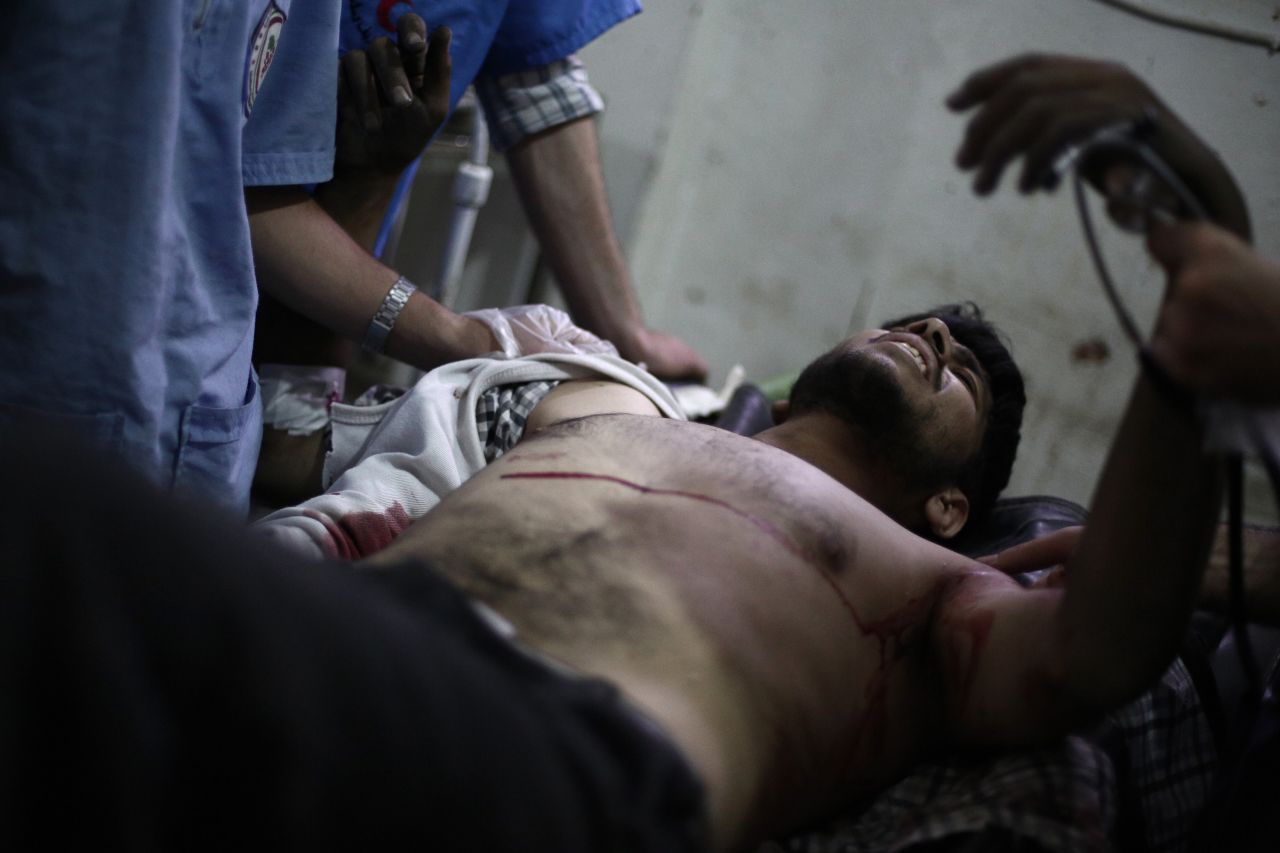 A Syrian rebel fighter lies on a stretcher at a makeshift hospital in Douma, Syria, on Wednesday, July 9. He was reportedly injured while fighting ISIS militants.