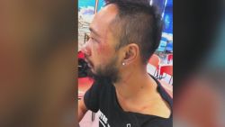 pkg tank hong kong protester alleged beaten_00001207.jpg
