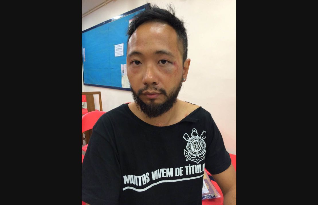 Photos show bruising on Ken Tsang's face.