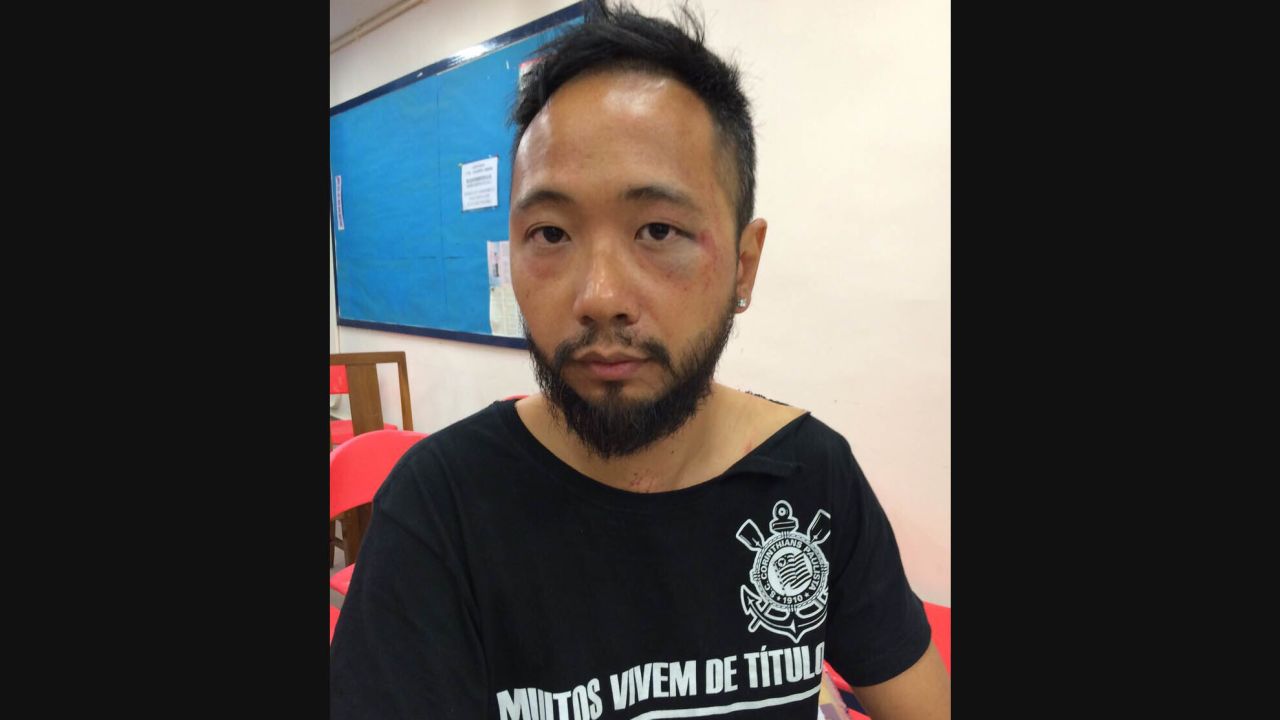 Photos show bruising on Ken Tsang's face.
