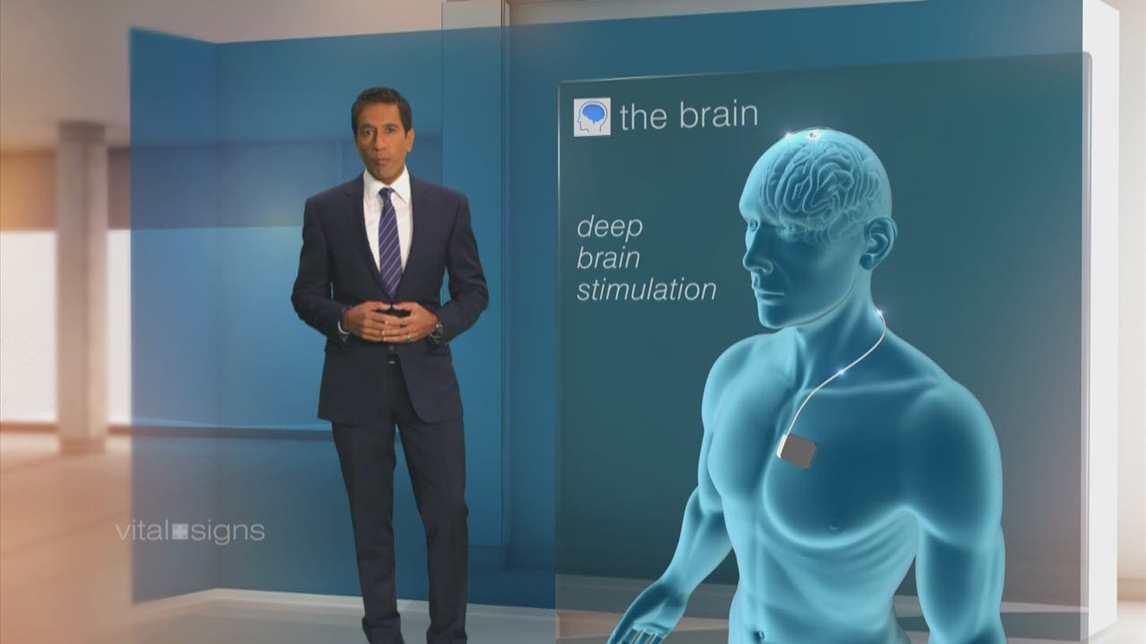 spc vital signs gupta brain a_00011101.jpg