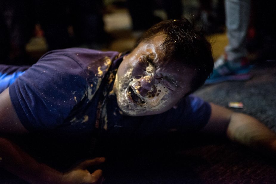 A journalist collapses in agony after being hit in the face with pepper spray during clashes with police on Friday, October 17.