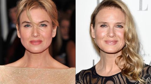 Renee Zellweger S Face Why So Much Criticism Cnn