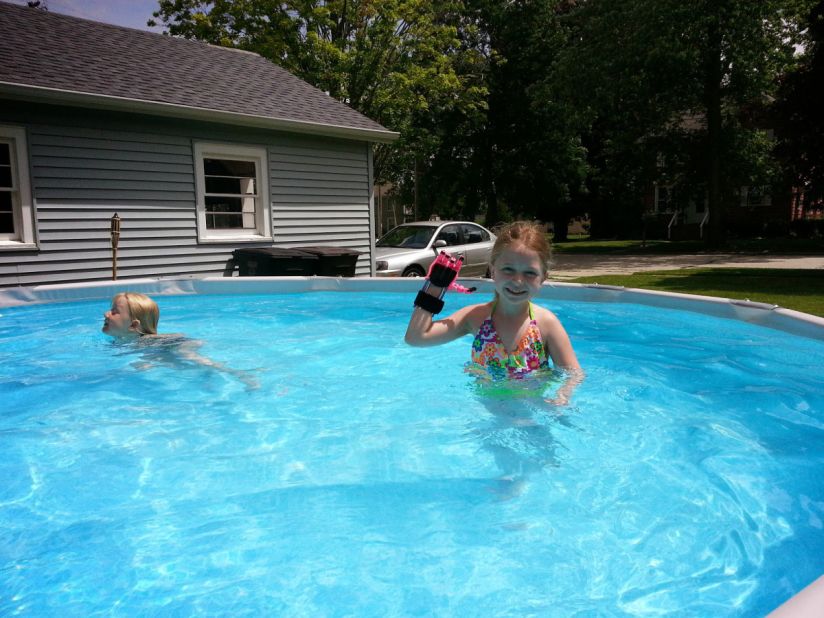 Shea plays in a swimming pool with another one of her hands. 3-D printed hands are light, cheap and waterproof. 