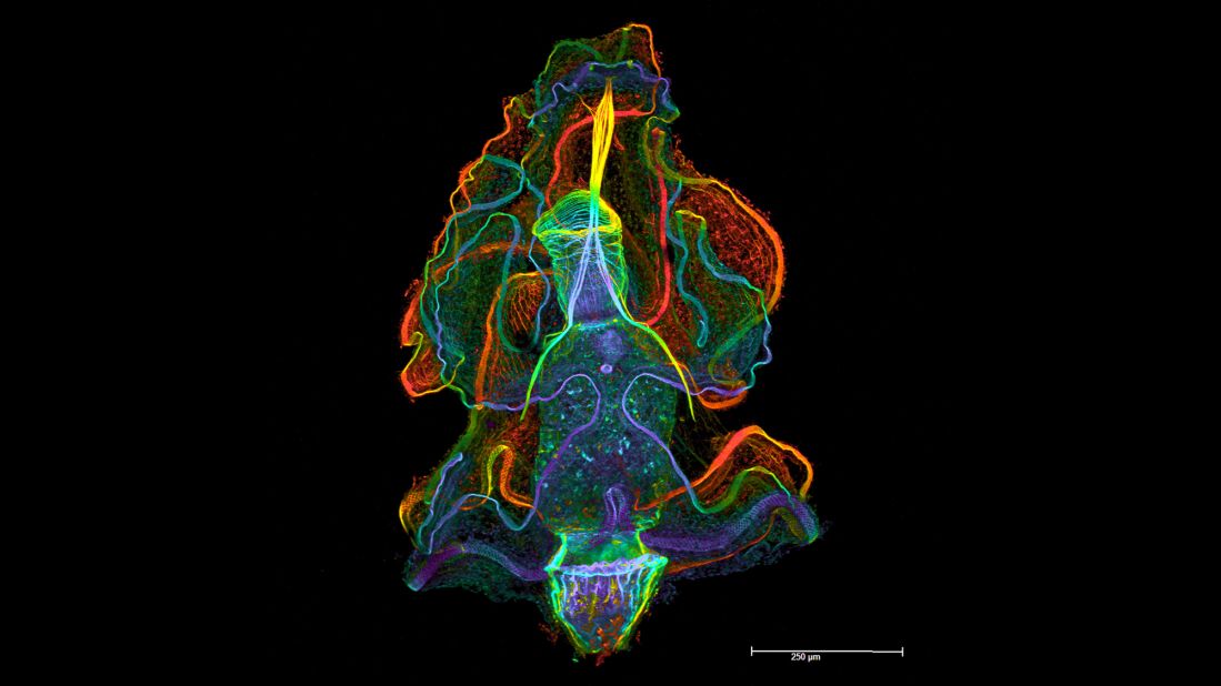 <strong>19th place: Dr. Sabrina Kaul, University of Vienna</strong> <br /><br />Larval stage of the acorn worm Balanoglossus misakiensis, dorsal view, showing cell borders, muscles and apical eye spots