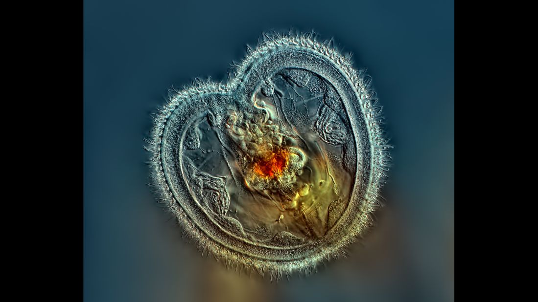 This is the 40th year that camera maker Nikon has held its Small World competition, which seeks the best magnified images melding science and art. Finishing in first place this year was Rogelio Moreno, who took this magnified photo of a rotifer that shows its mouth interior and heart-shaped corona.