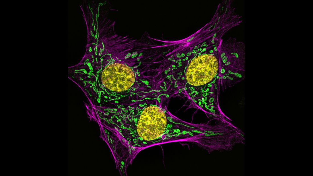 <strong>Fifth place: Dr. Muthugapatti K. Kandasamy, Biomedical Microscopy Core, University of Georgia</strong> <br /><br />Bovine pulmonary artery endothelial cells, stained for actin (pink), mitochondria (green) and DNA (yellow)